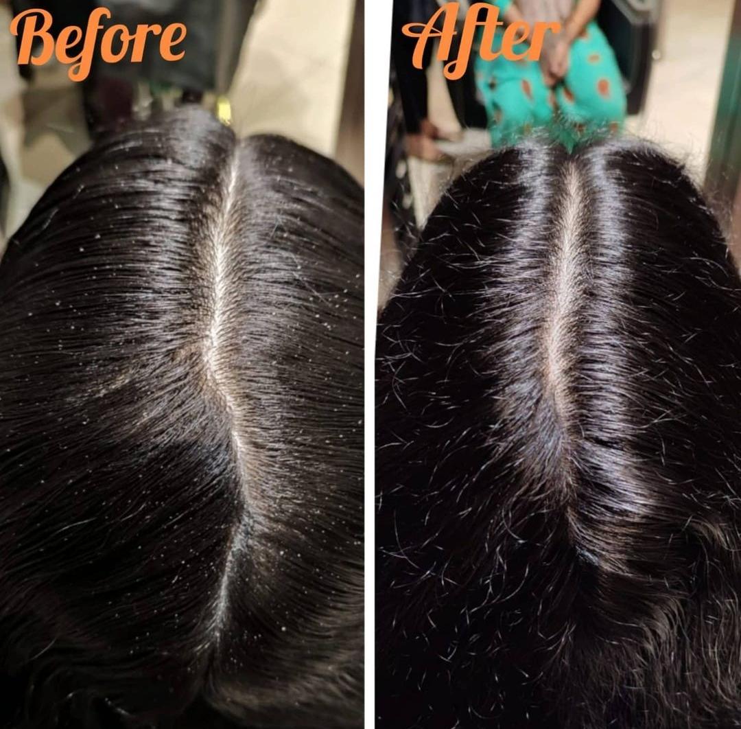 GLOW MAX BEAUTY SALON AND SKIN CARE VETTICHIRA