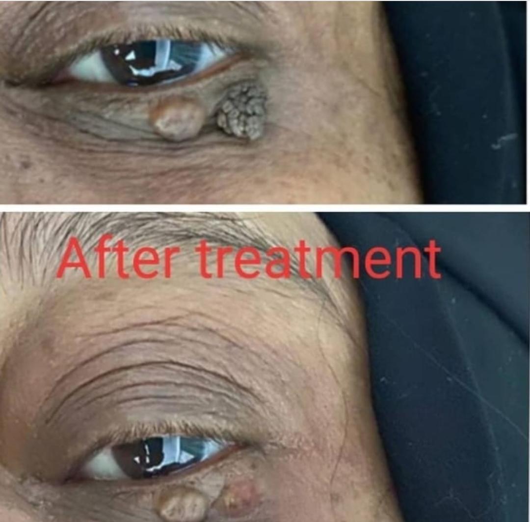 GLOW MAX BEAUTY SALON AND SKIN CARE VETTICHIRA